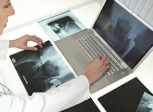 Female doctor examines radiographs and makes inputs on the PC| BFCC - a project of Interreg Baltic Sea Region (photo: Shutterstock/SpotmatikLtd)
