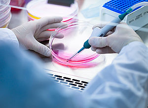 looking a technician over his shoulder who is holding a petri dish an electrical pipette | BIC - a project of Interreg Baltic Sea Region (photo: Panthermedia/martinpolak)