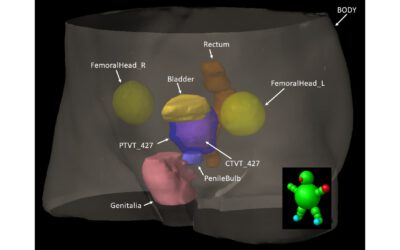 Pilot use case: Protective Mapping at Radiation Therapy (PMRT)