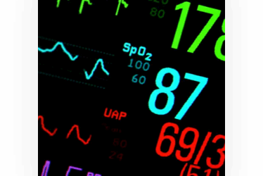 Pilot use case: Shock prediction in ICU (SPICU)
