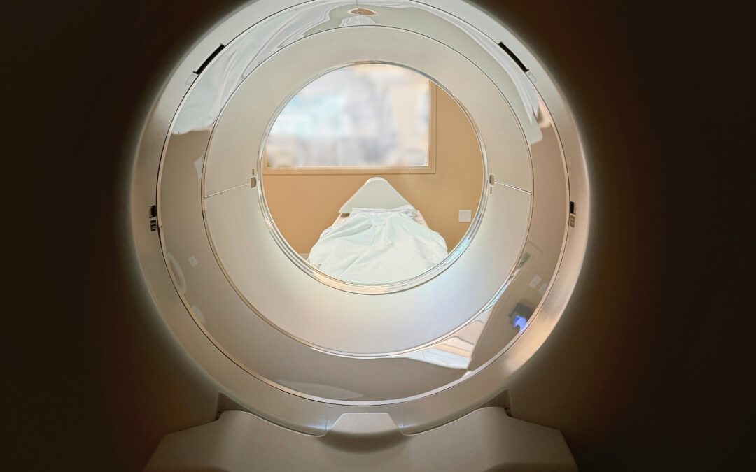 Pilot use case: AI Contouring Tool