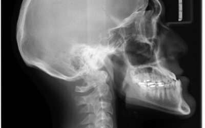 Pilot use case: Better Medicine